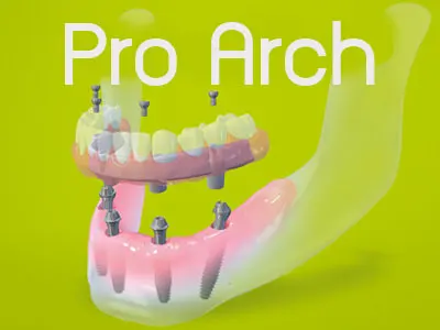 Pro arch